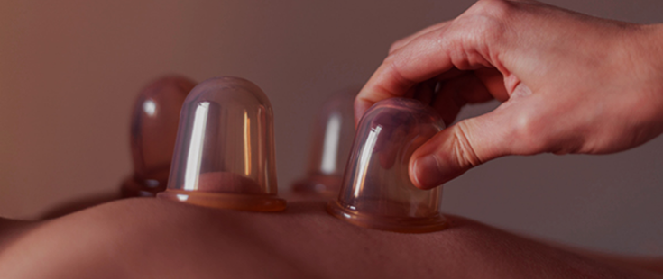 Cupping Massage
